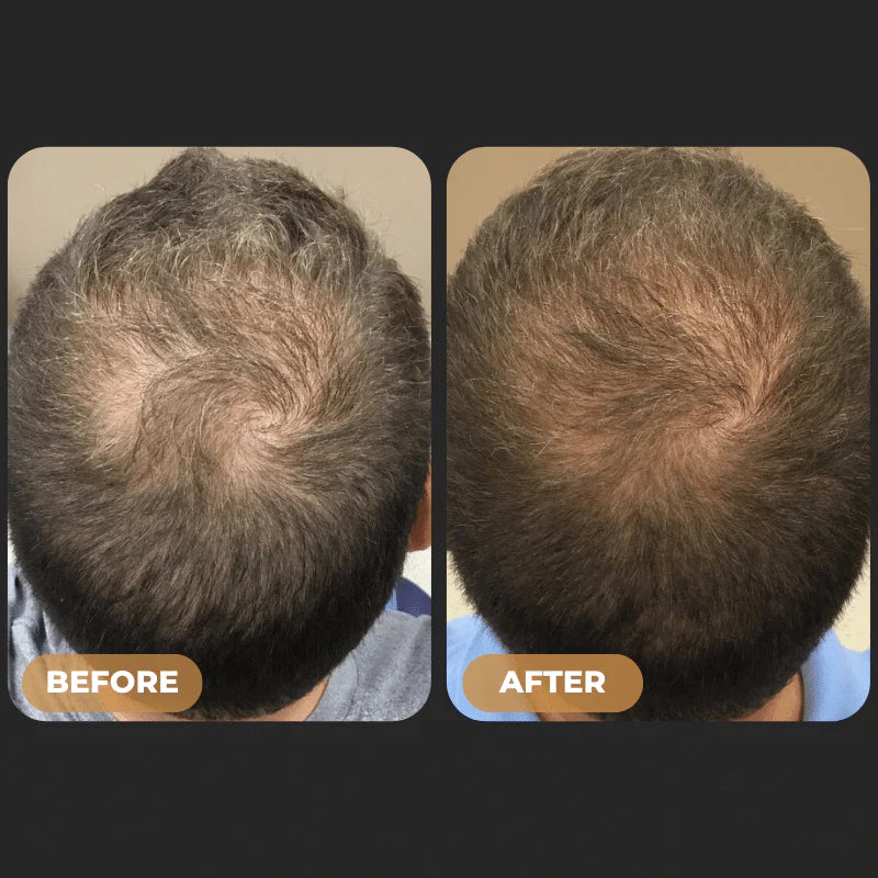 SPARTAN™ Root Activator Shampoo For Men Hair Loss