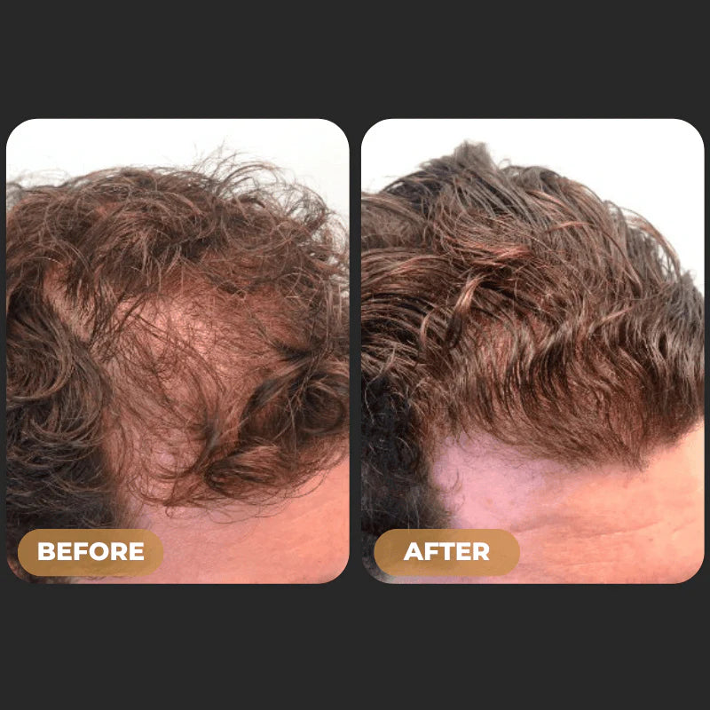 SPARTAN™ Root Activator Shampoo For Men Hair Loss