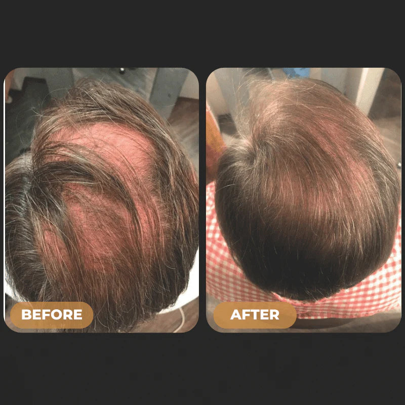 SPARTAN™ Root Activator Shampoo For Men Hair Loss