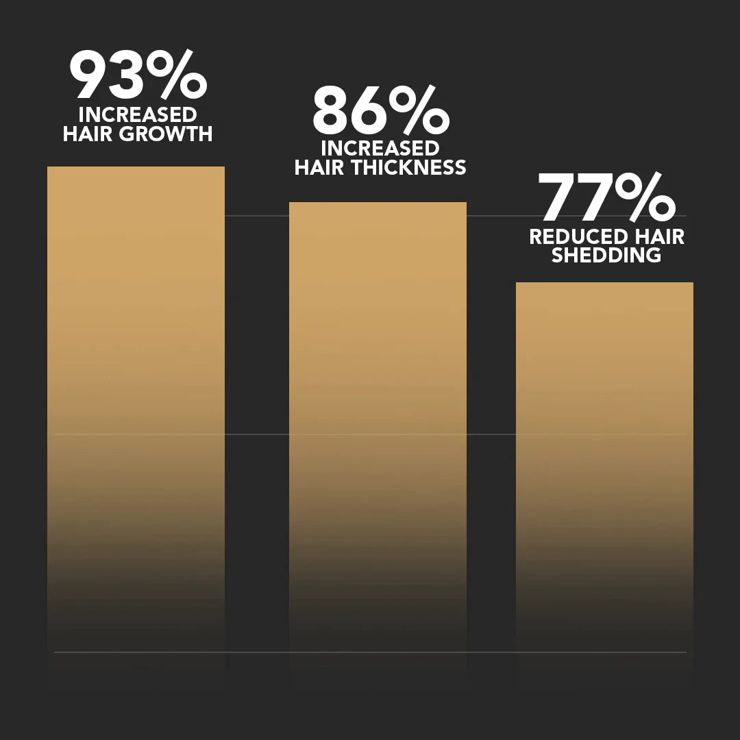 SPARTAN™ Root Activator Shampoo For Men Hair Loss