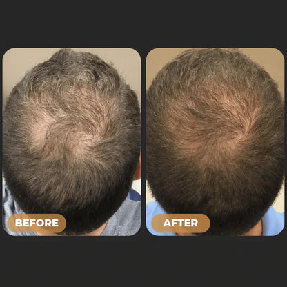 SPARTAN™ Root Activator Shampoo For Men Hair Loss